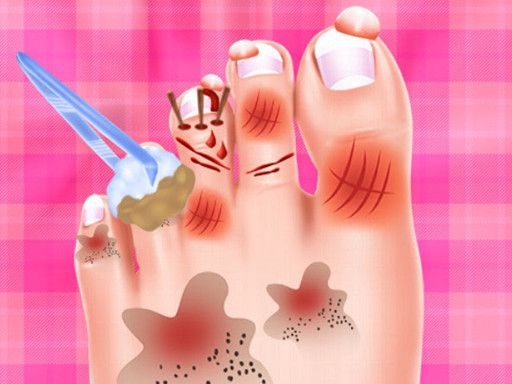 Baby Taylor Foot Treatment - browser game screenshot