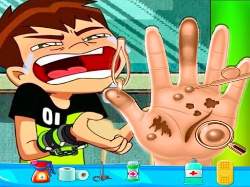 Ben10 Hand Doctor - Free Online Game - browser game screenshot