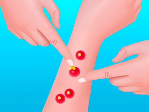 Pimple Poper Rush - browser game screenshot